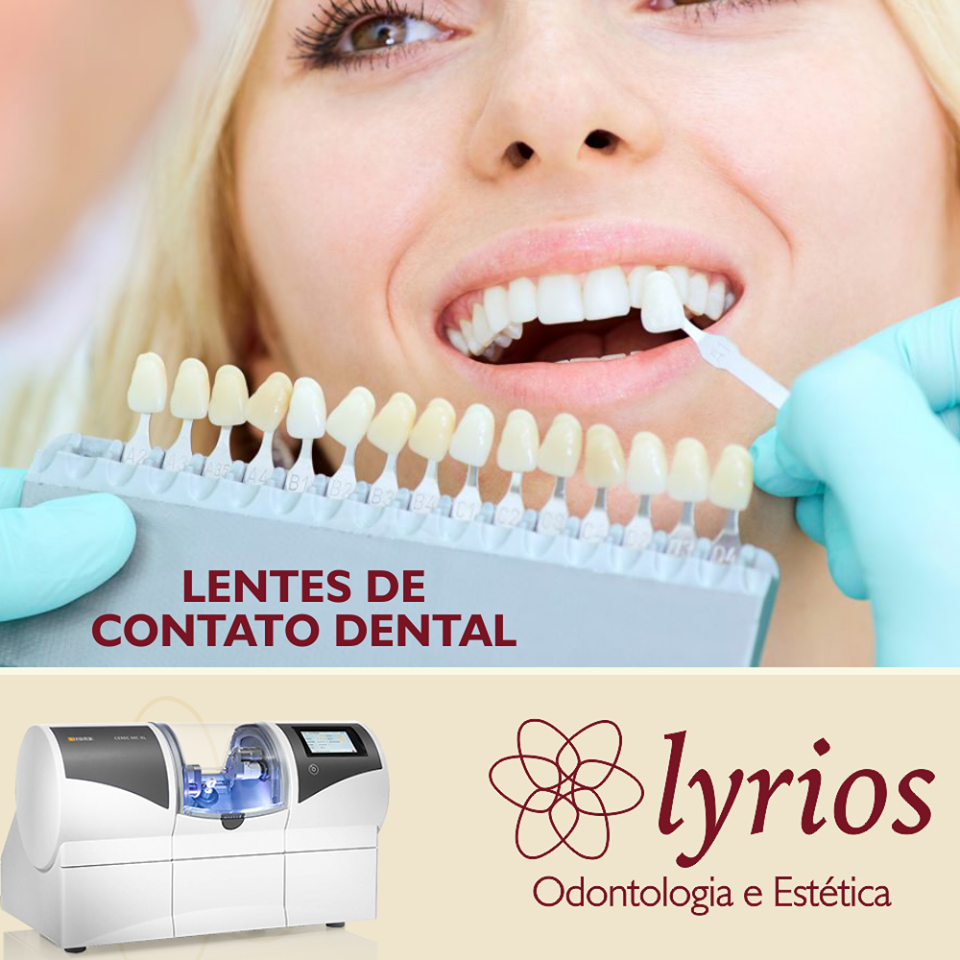 lentes de contato dental em um dia